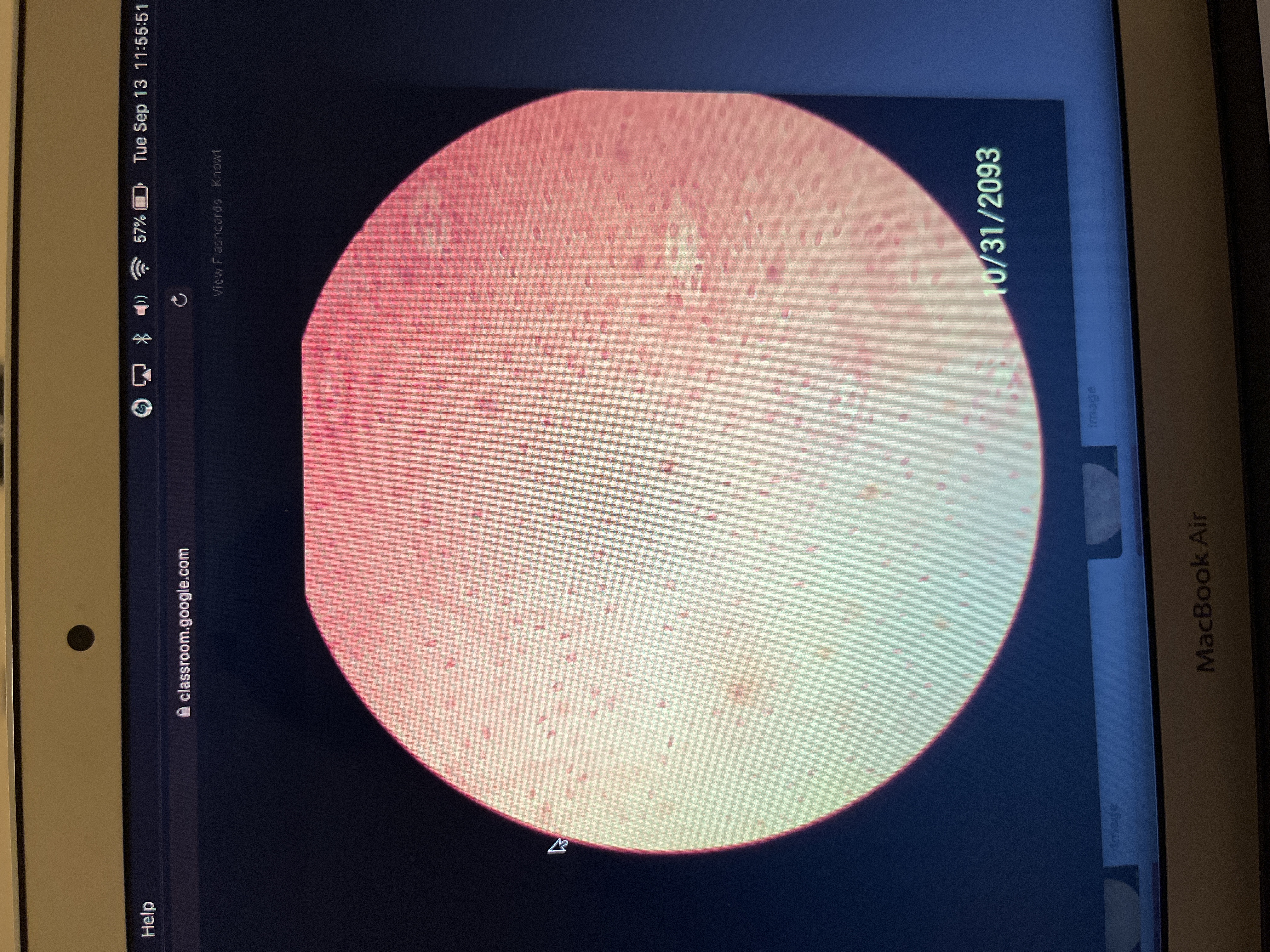 Location: superficial layer of skin 
Function: protection against abrasion 