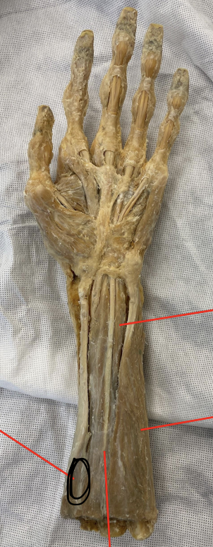 <p>identify + state origin, insertion, action, innervation of marked structure</p>