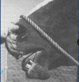 <p><span style="background-color: transparent;"><span>Nigropallidal encephalomalacia</span></span></p>