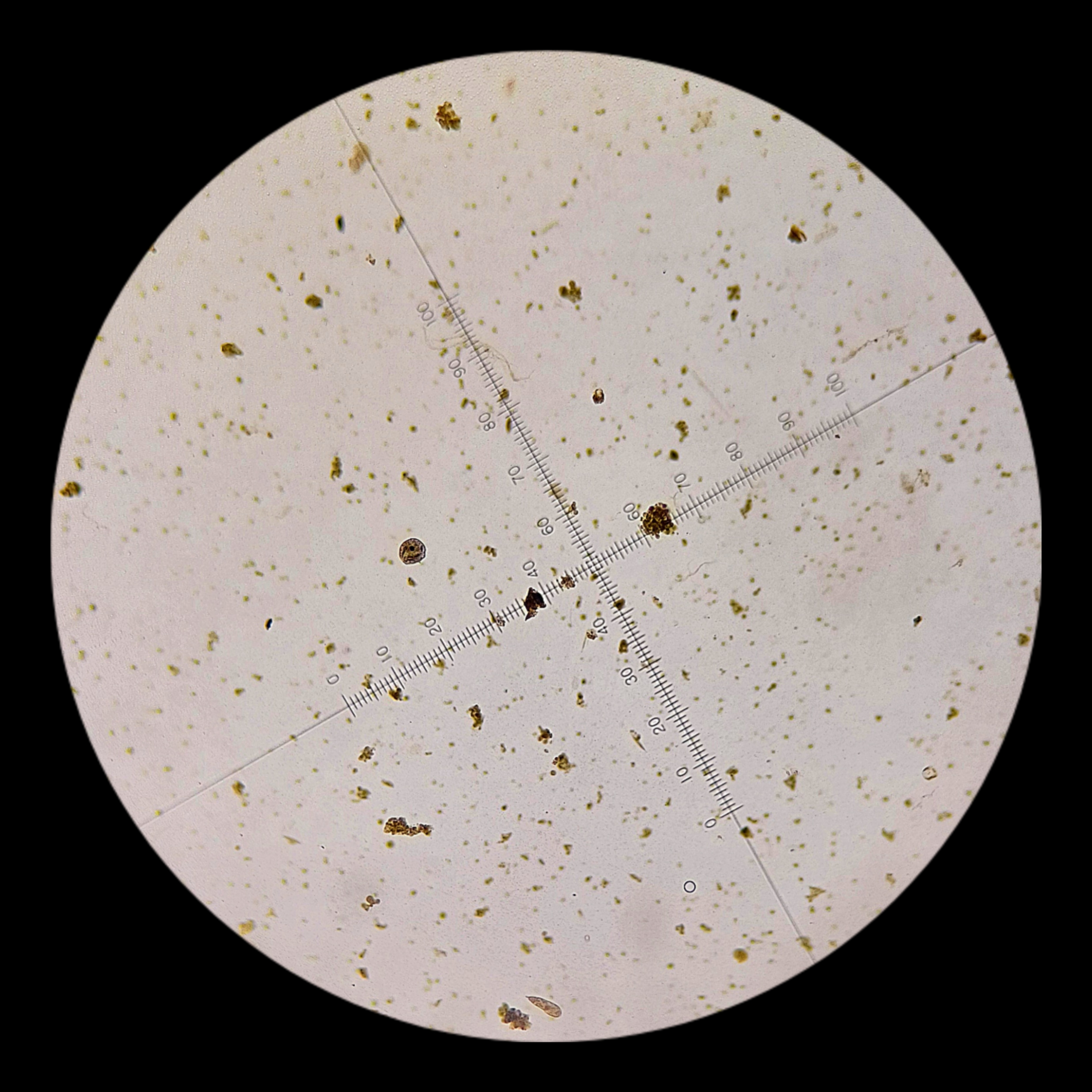 <p><strong><em>Chlamydomonas</em></strong></p><p><strong>Phylum: ?</strong></p>