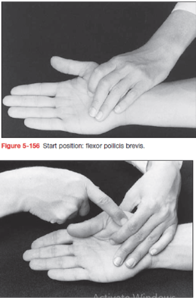 <p>KH: könyök enyhe flexio, alkar supinatio, hüvelykujj pici abdukcióban</p><p>Rögzítés: I. MC-t</p><p>MCP-t flektálja extendált IP mellett!</p><p>Ellenállás: proximalis phalanxra flexioval szemben</p>