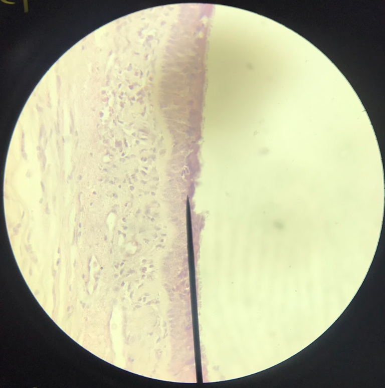 <p>nucleus gives an impression of stratification/layering, but upon close examination, all of the cells are attached to the basement membrane; on the free surface of the cells are hair-projections called <strong>cilia</strong></p>