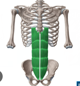 <p>Rectus Abdominis </p>