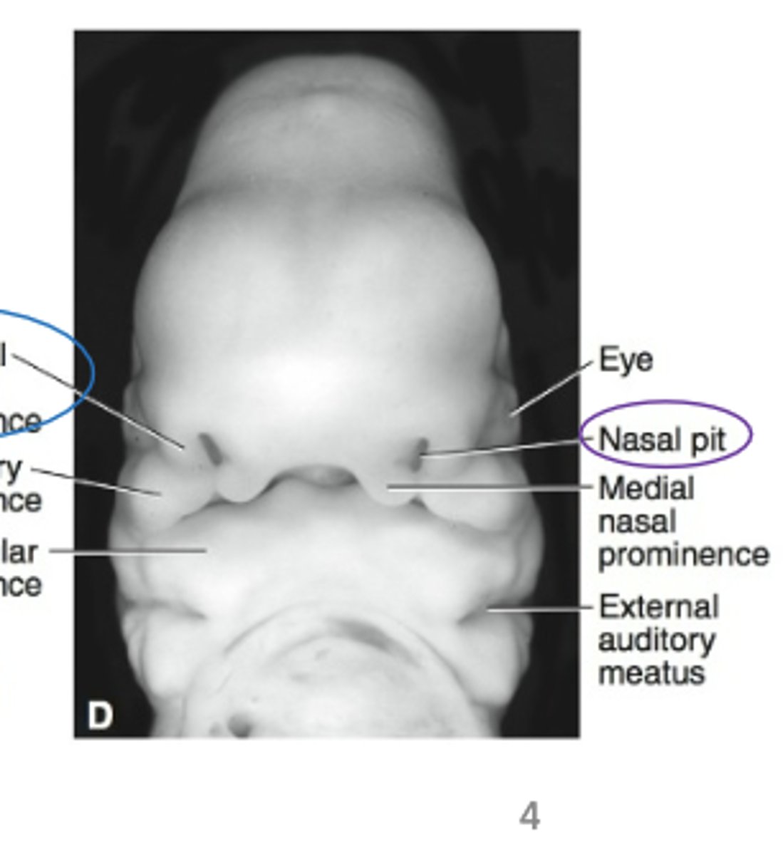 <p>The nasal pit (depression) between each pair of nasal prominences represents</p>
