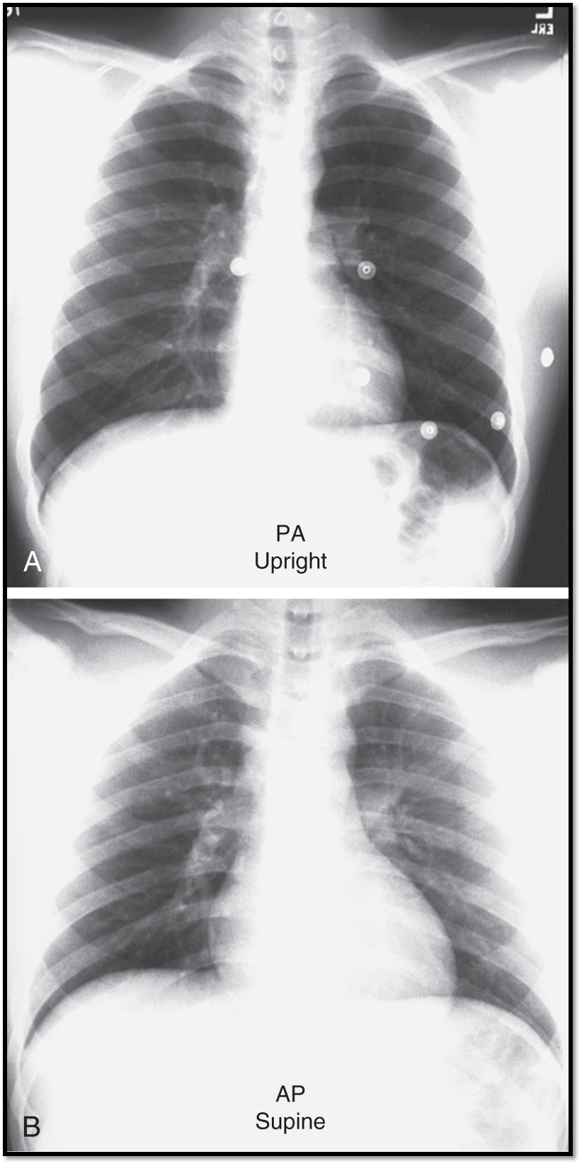 <ul><li><p>patient positioning</p></li><li><p>beam direction</p></li></ul><p></p>