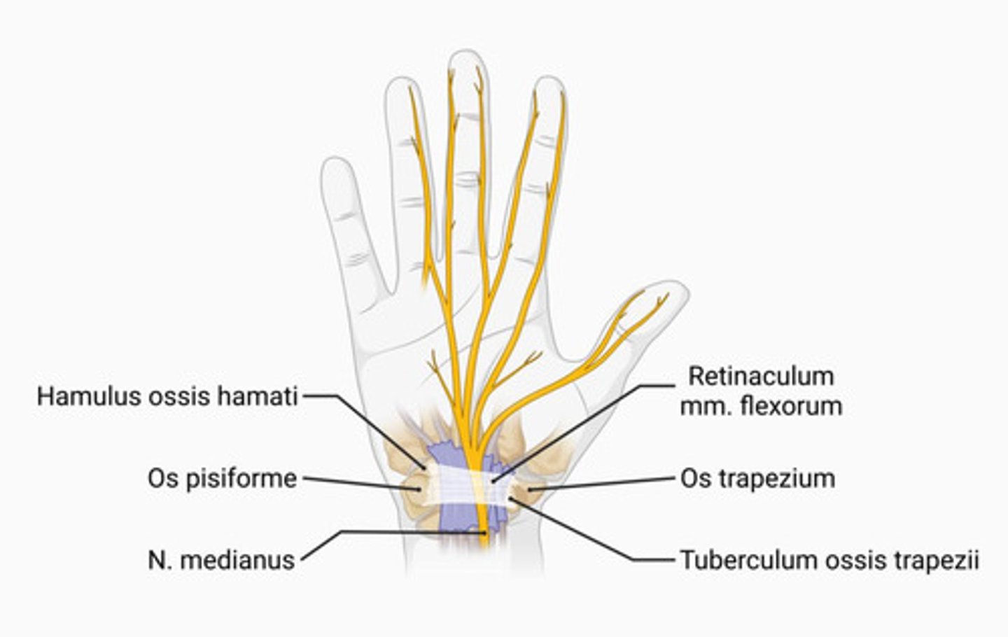 <p>thenar izmok atrófiája</p><p>(beidegzi: m. abductor pollicis brevis, m. opponens pollicis, m. flexor pollicis brevis superficialis része)</p>