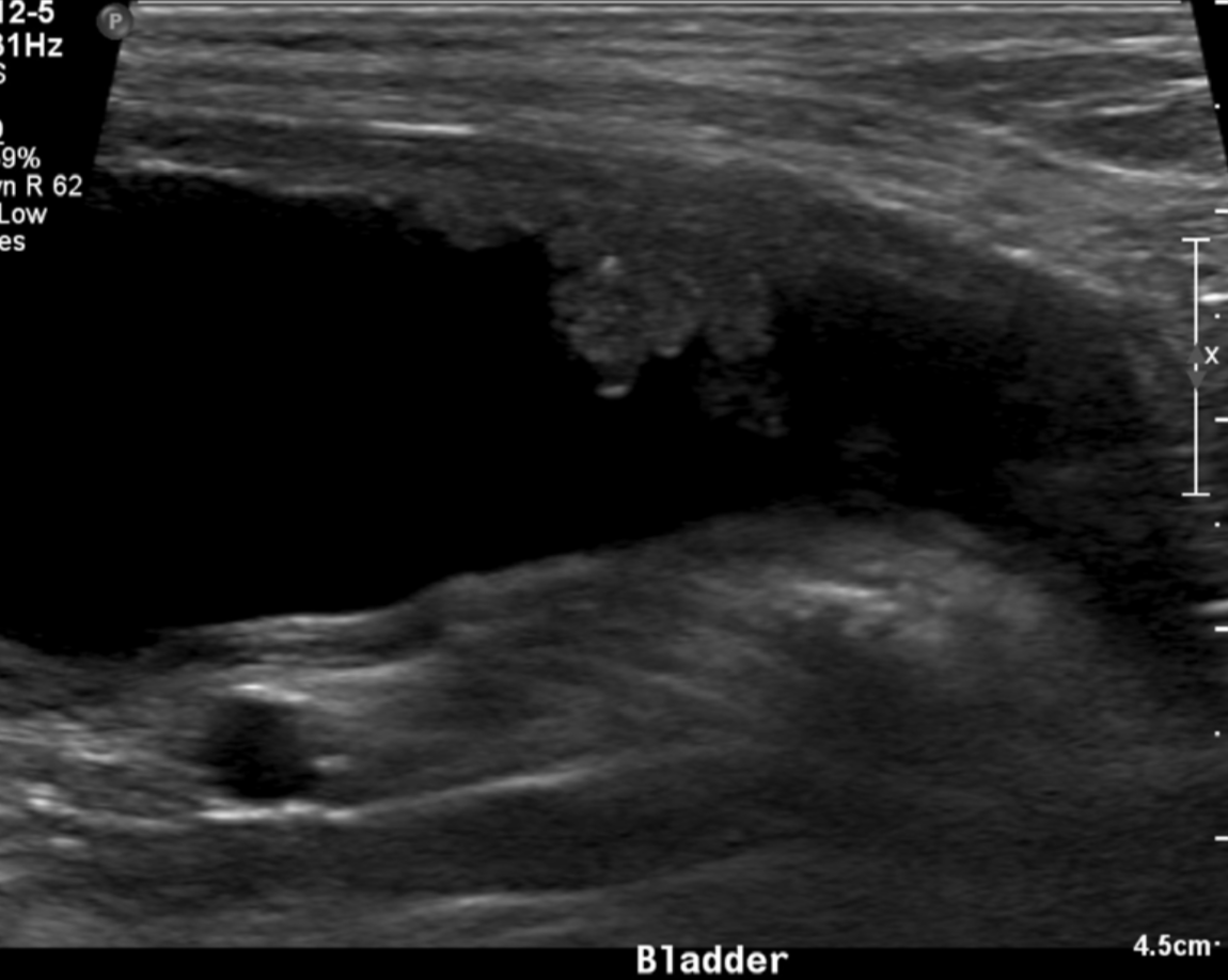 <p>OLD DOG bladder</p>