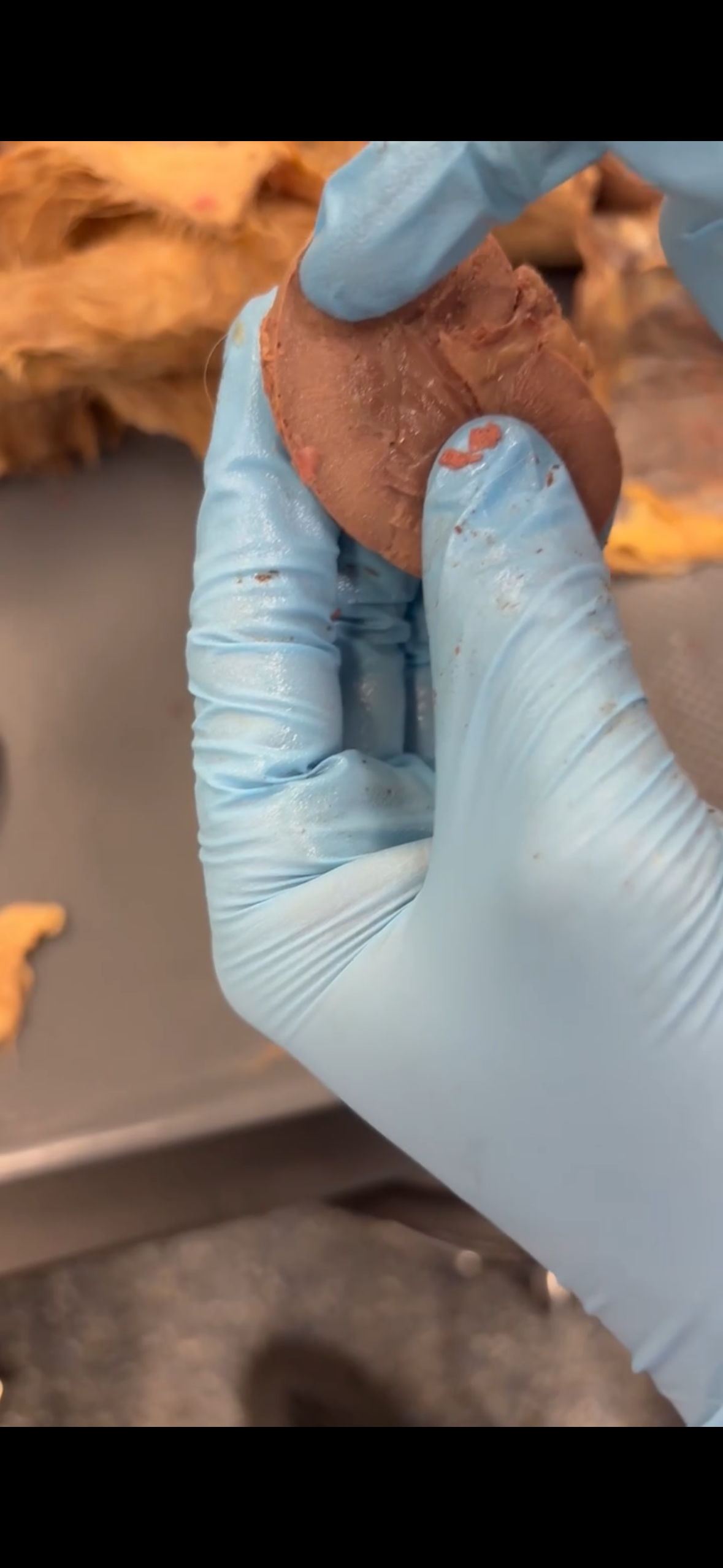 <p>Outer part of Inner Kidney (Right hand finger)</p>