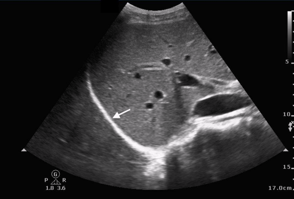 <p>what are inferior and superior to the diaphragm?</p>