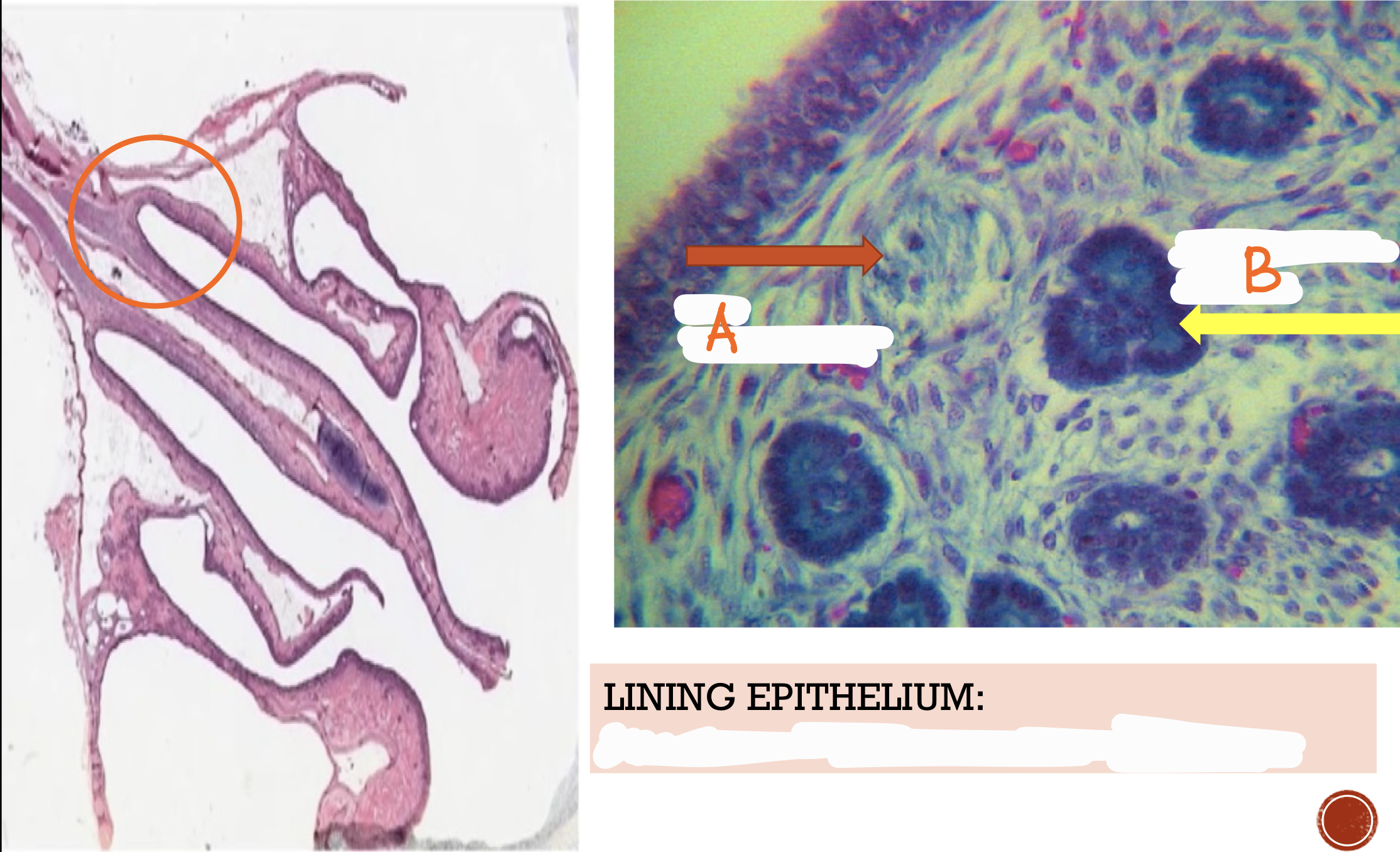 <p>Identify the structures and lining epithelium</p>