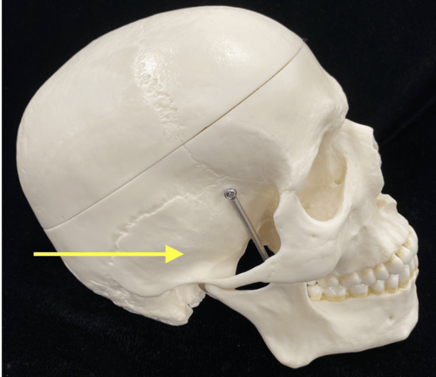<p>name the bone </p>