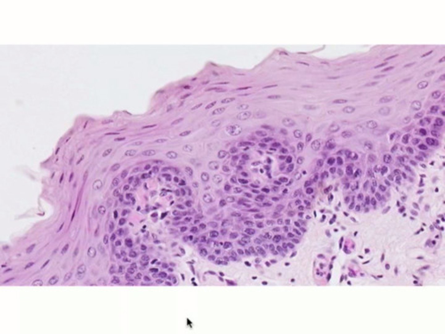 <p>epithelial tissue with dead cells filled with keratin as the TOP LAYER (most apical)</p><p>- i.e. Mammalian skin</p><p>FUNCTION: protects against abrasion</p>