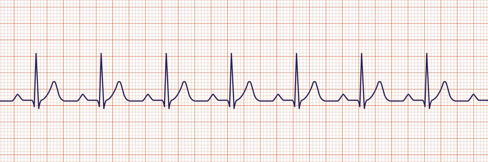 <p>What Rhythm is This?</p>