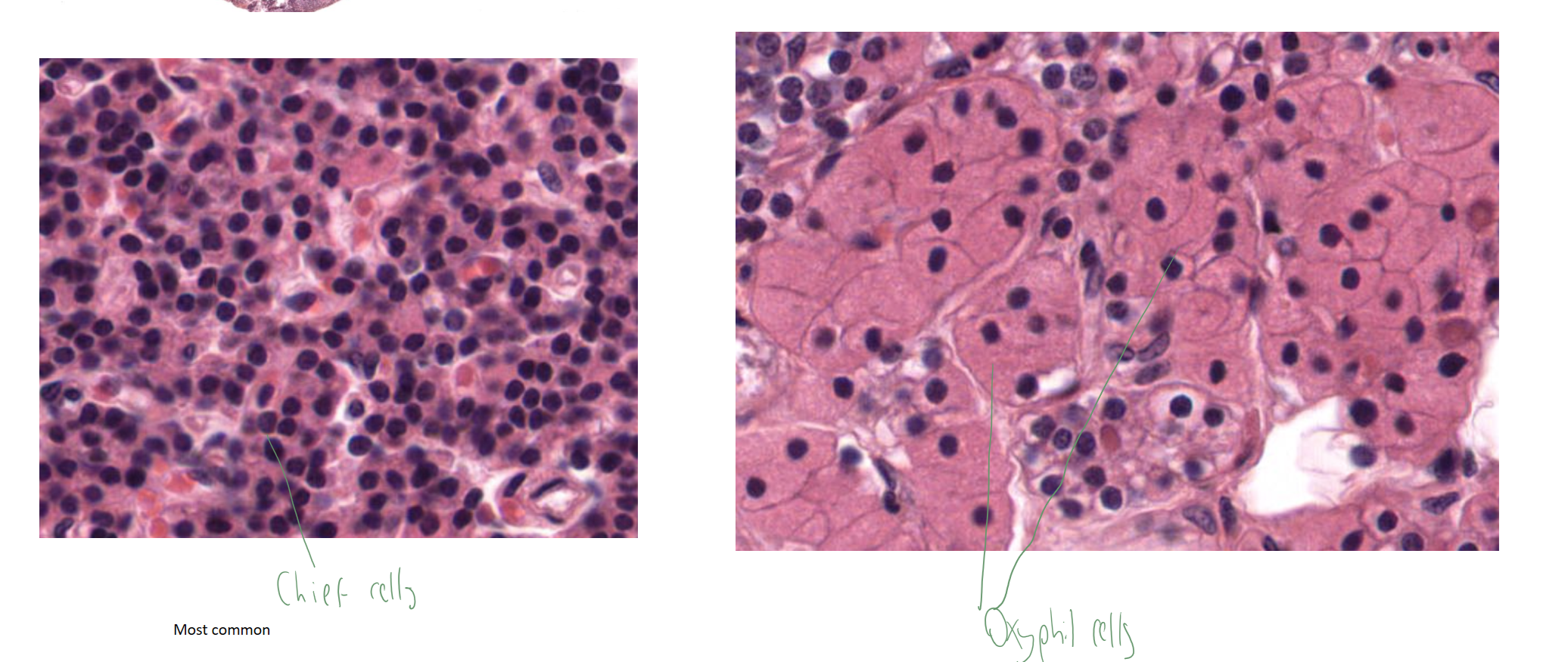 <p>oxyphil cells &amp; chief cells (produce PTH) </p>