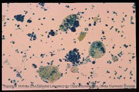 <ul><li><p>not normally found</p></li><li><p>yellow-brown granules</p></li><li><p>associated with rbc destruction</p></li><li><p>confirm with prussian blue</p></li></ul><p></p>