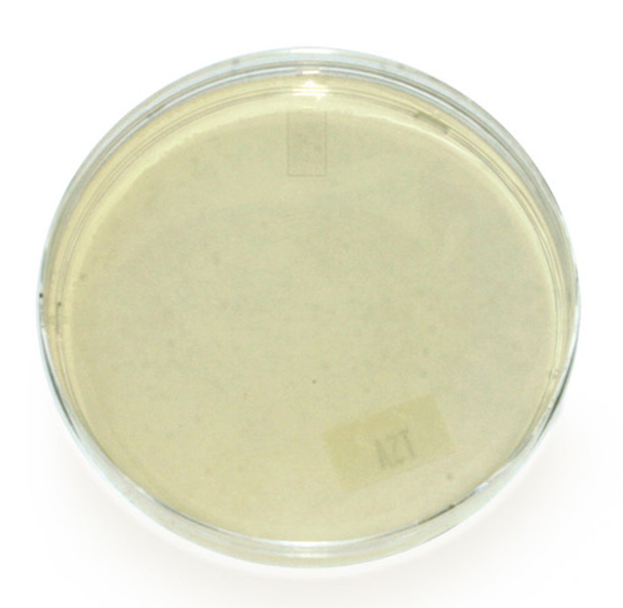 <p>The nutrients are harder to extract from agar media so the culture lives longer.</p>