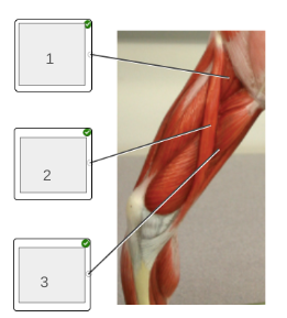 <p>name muscles 1-3</p>