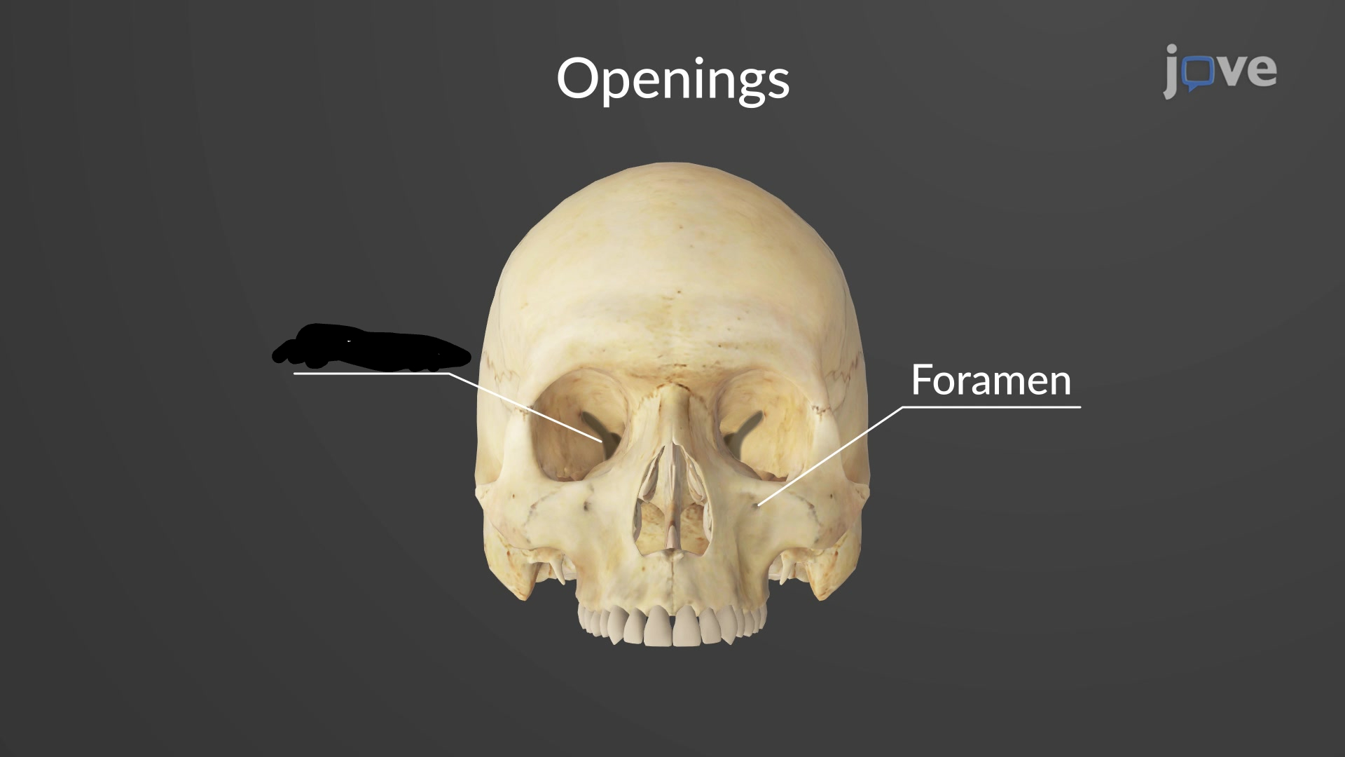 <p>a long cleft; opening in bones for nerves and vessels</p>