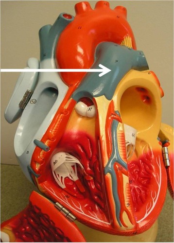 <p>branches into R &amp; L pulmonary arteries</p>