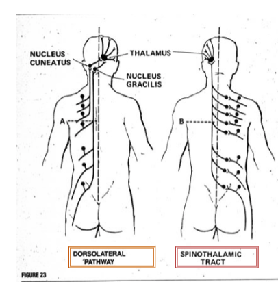 <p>which pathway would result in ipsilateral deficit vs contralateral?</p>