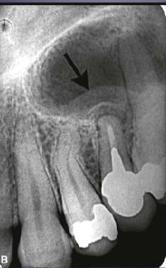 <p>what’s the arrow pointing to</p>