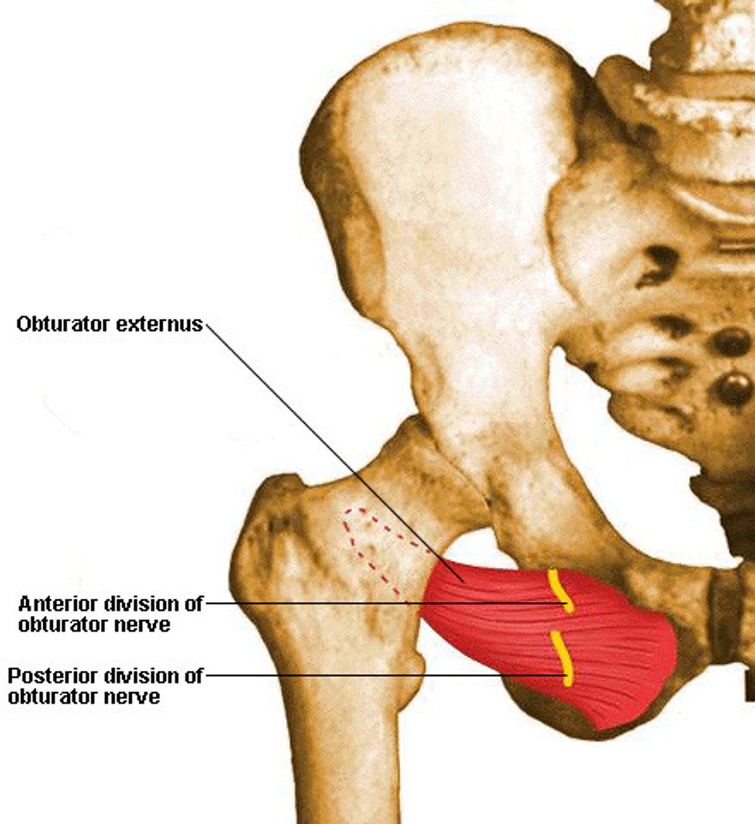 <p>Medial thigh</p><p>Proximal attachment</p><p>- External surface of obturator membrane and bony margins of obturator foramen</p><p>Distal attachment</p><p>- Greater trochanter</p><p>Innervation</p><p>- Obturator nerve</p><p>Action</p><p>- Hip external rotation/lateral rotation</p>