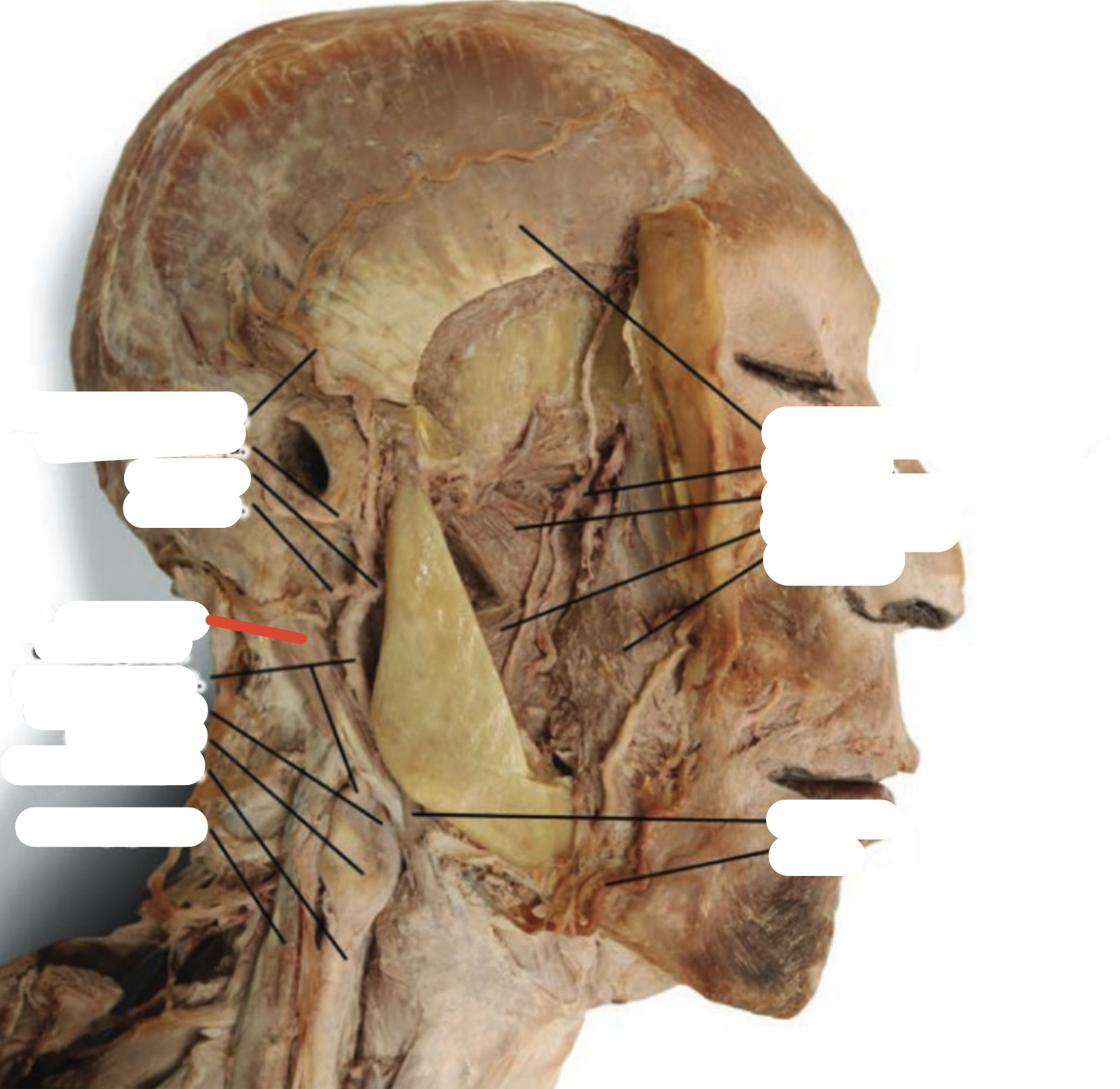Identify the structure (red line)