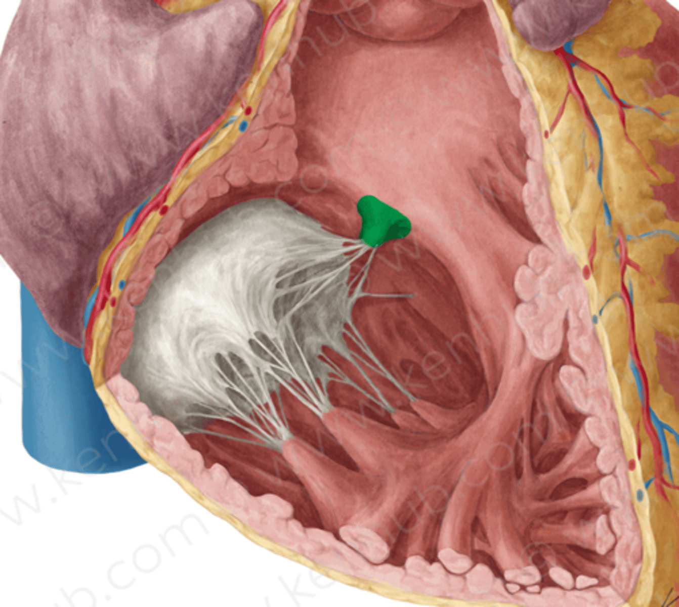 <p>arises from interventricular septum and attaches to anterior and septal cusps</p>