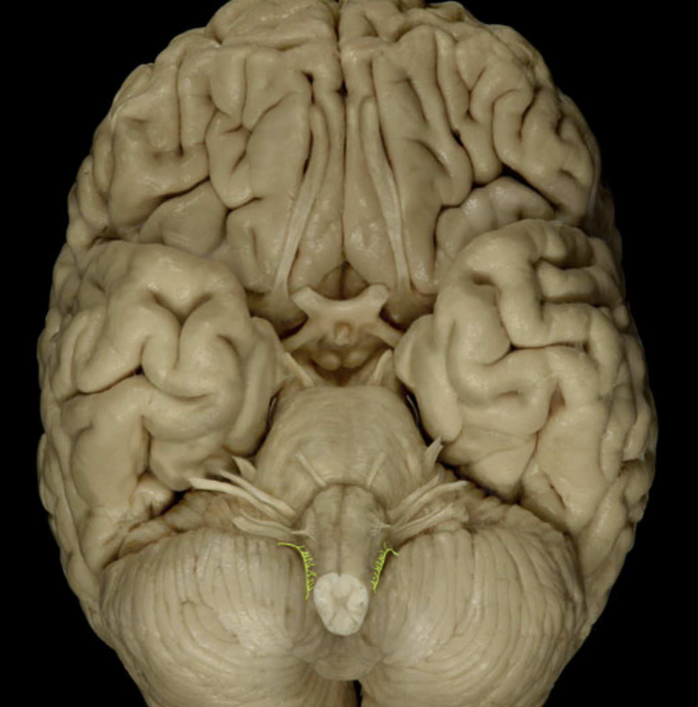 term image