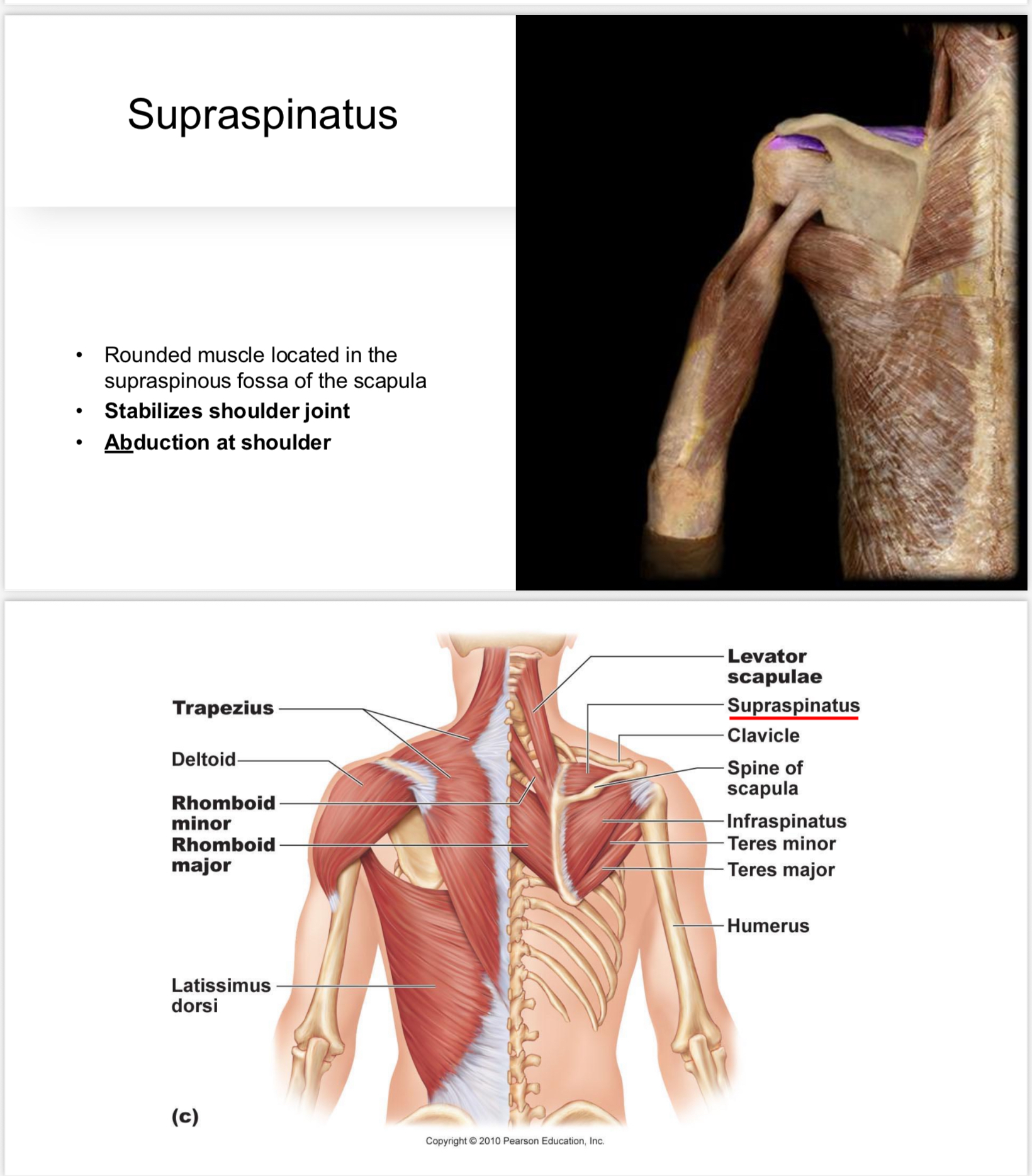 <p>Muscle that facilitates abduction of the shoulder.</p>