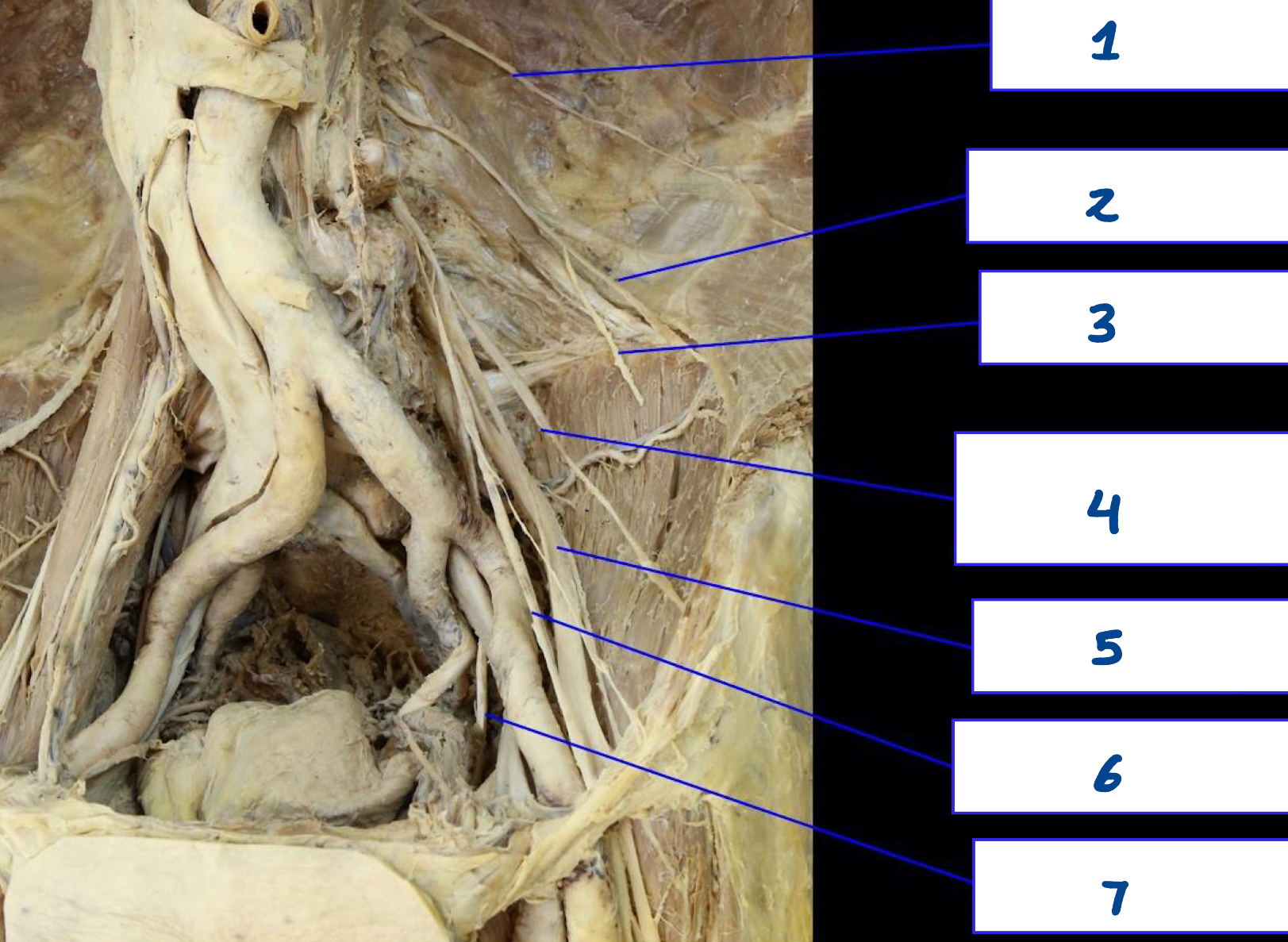 <p>What is structure 5?</p>