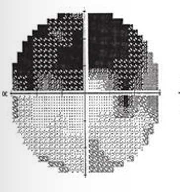 <p>What kind of defect is this</p>