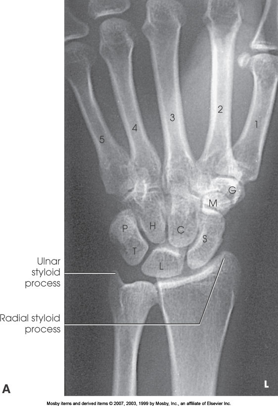 <p>What position is demonstrated?</p>