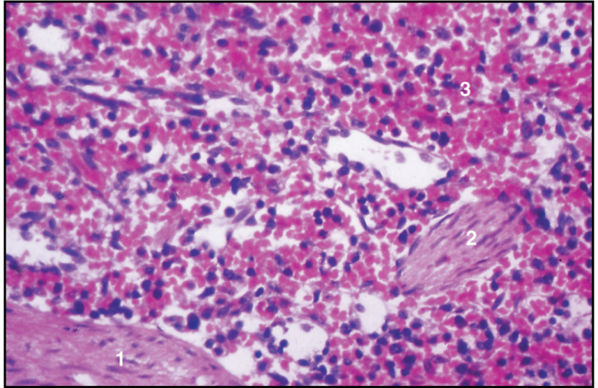 <p>spleen, cat</p>