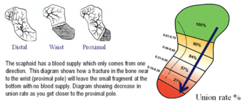 X-ray every week or two 
looking for evidence of healing
if not - bone graft