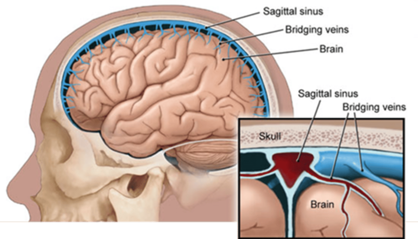 <p>Veins that connect arachnoid layer to sinuses by puncturing the dural mater</p><p>drain into the dural venous sinuses</p>