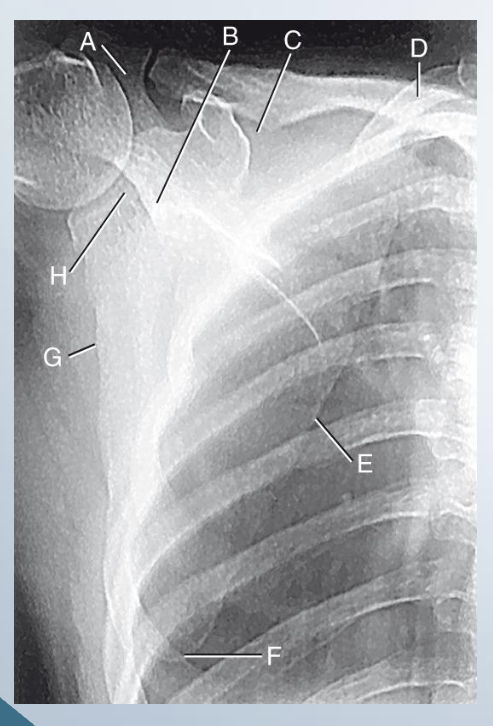 <p>AP scapula&nbsp;</p><p>LABEL</p>