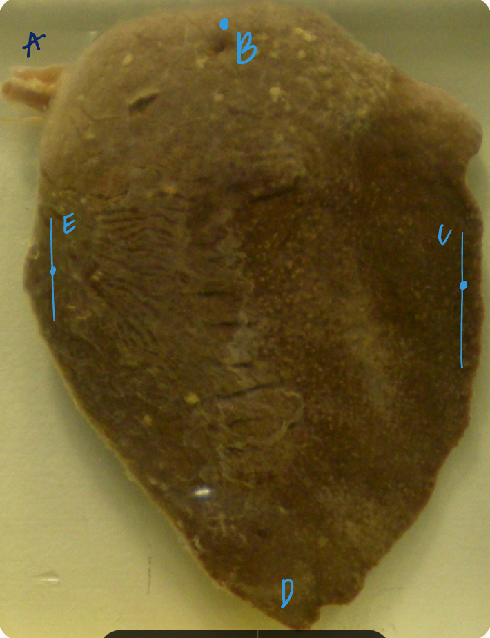 <p>E </p><p>(sheep spleen, parietal surface)</p>