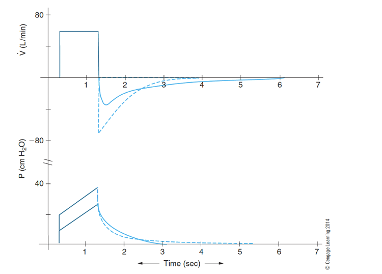 <p>What does loss of elastic recoil mean? What does that look like on a waveform? </p>