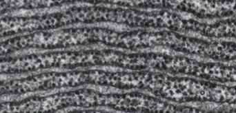 <p>What type of ER is this?</p>