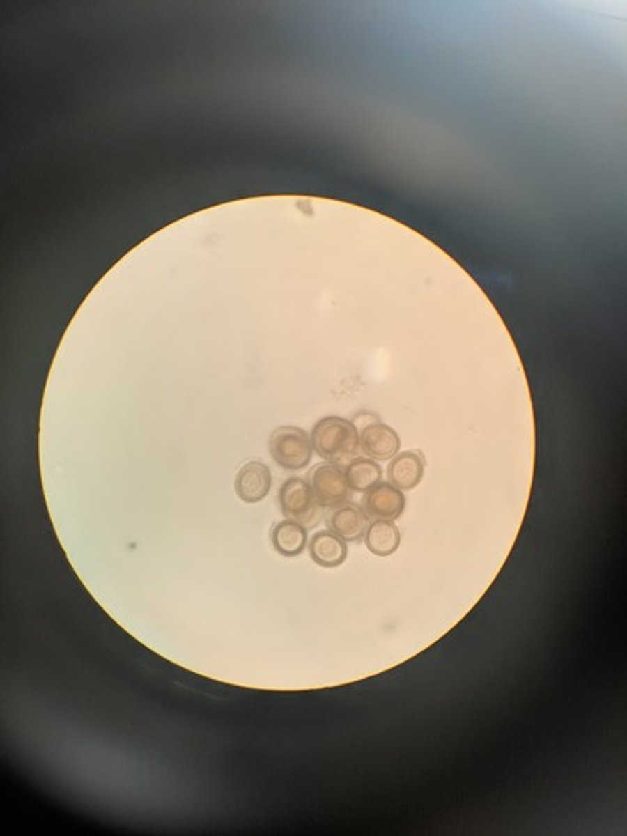 <p>Ingestion of Larvae or eggs, (if eggs, man is intermediate host, if larvae, pig is int. host.)</p><p>- pork tapeworm</p><p>- dx: fecal exam for tapeworm eggs or exam of affected tissues for larvae</p>