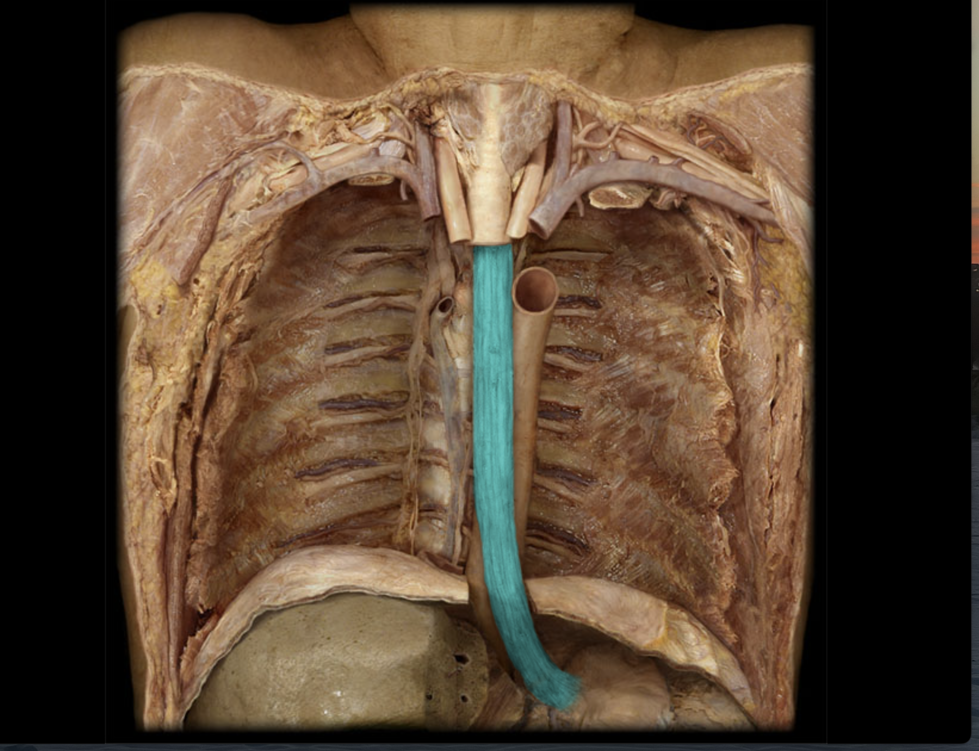 <p>Slants slightly to left (of patient) which directly connects to stomach</p>
