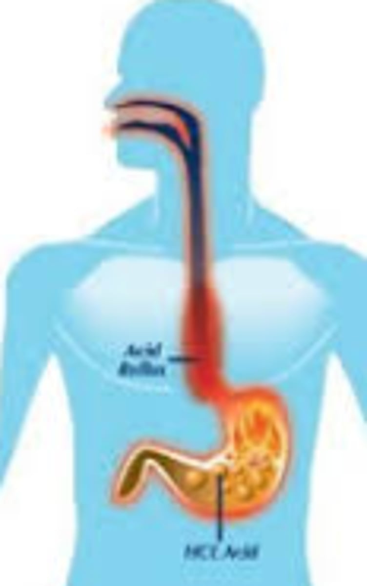 <p>Stomach acid that allows the protease enzymes to break down protein. Stops amylases from breaking down starch</p>