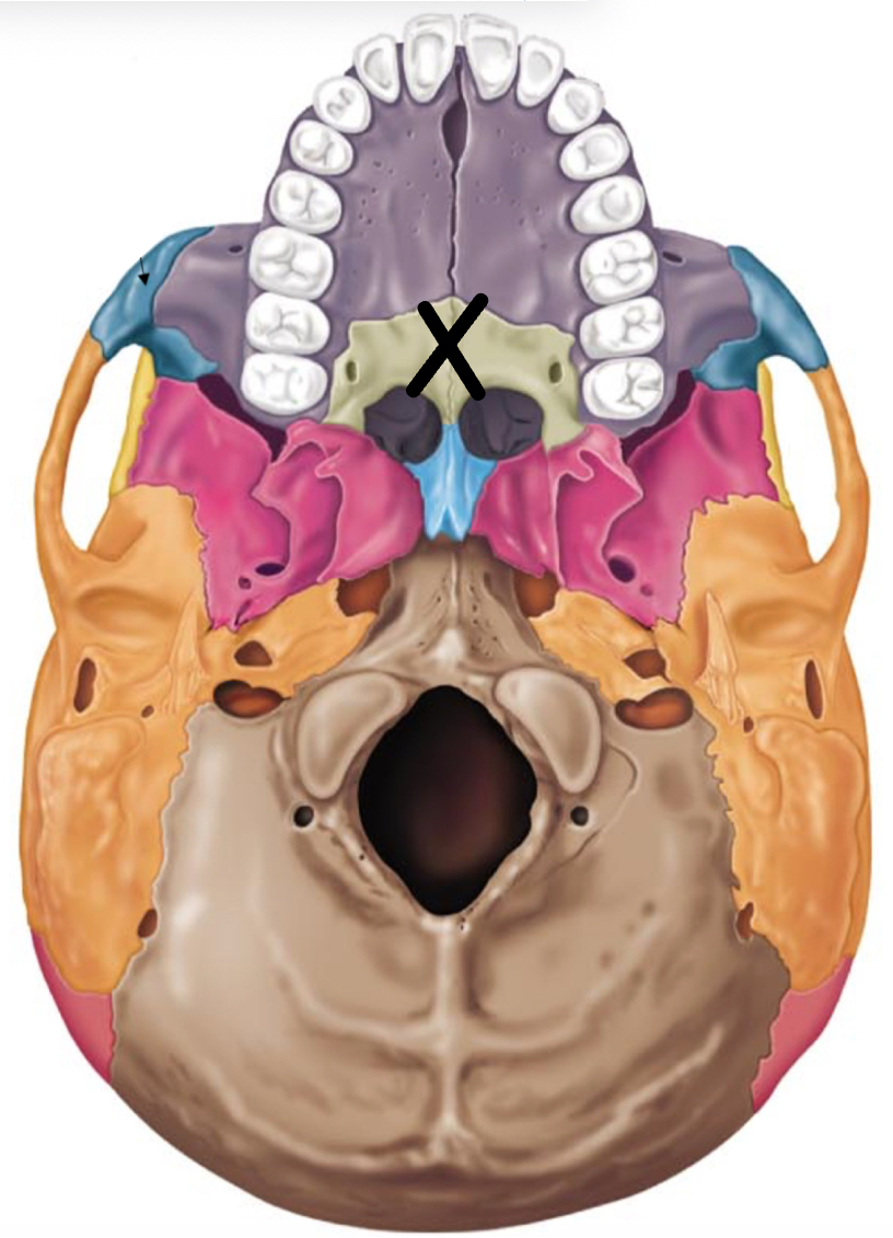term image