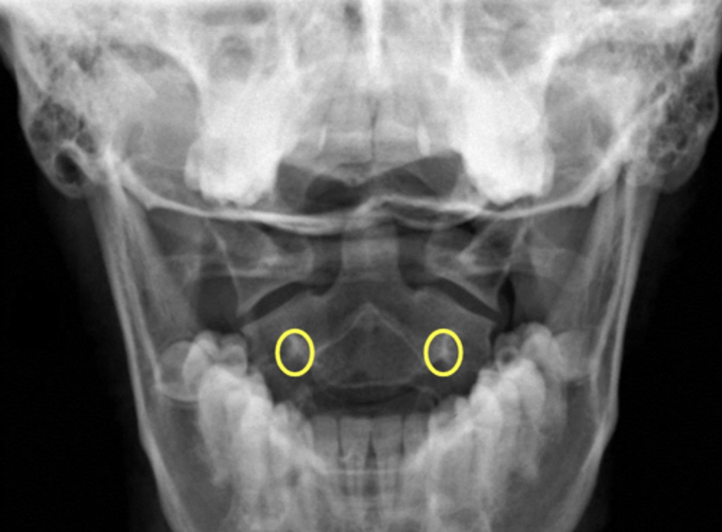<p>What are outlined in yellow?</p>