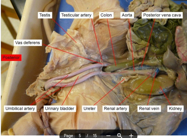 <p><mark data-color="unset" style="background-color: unset; color: inherit">paired blood vessels that carry deoxygenated blood and waste products from the developing fetus to the placenta</mark></p>