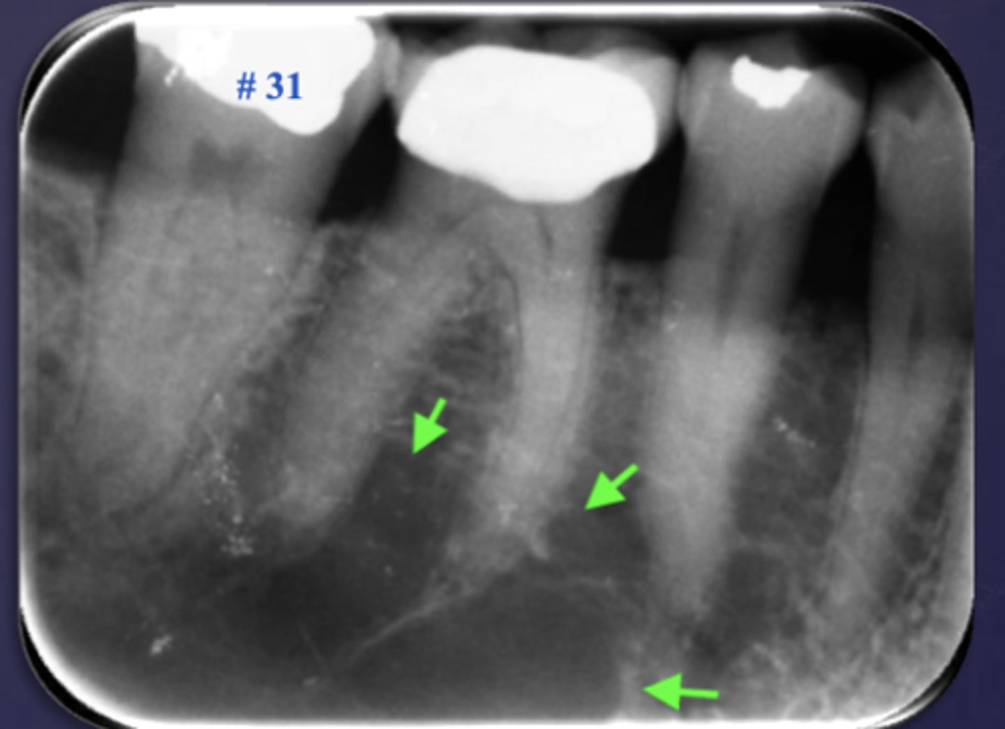 <p>What is the differential diagnosis?</p>