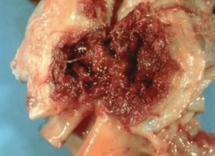 <p>Which parasite caused this damage to the mesenteric artery?</p>