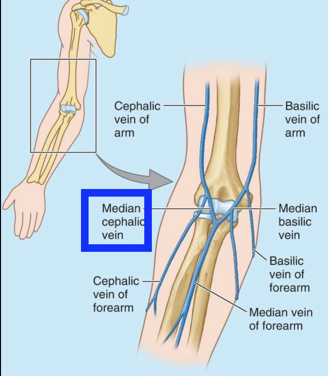 <p>right arm</p>