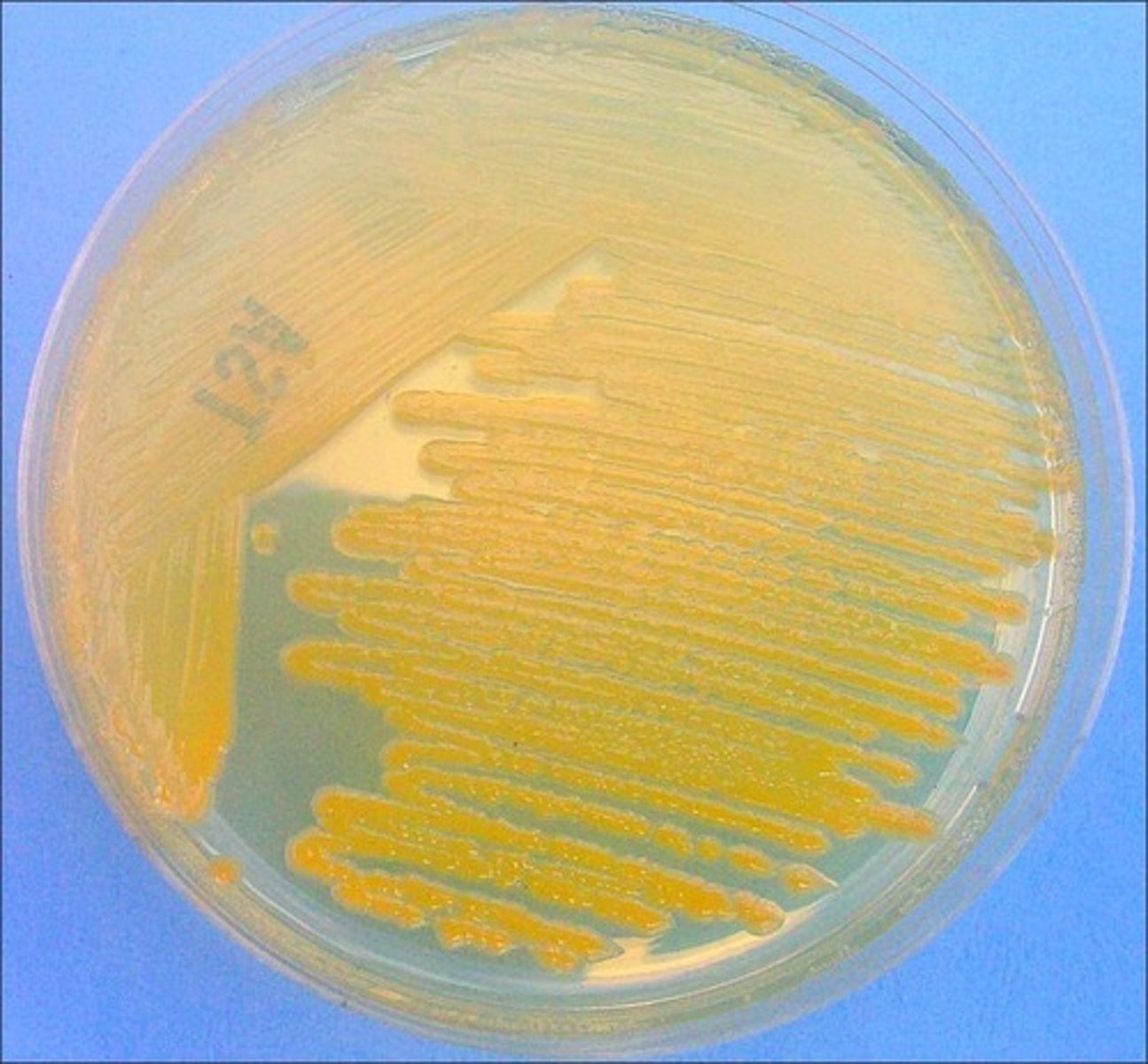 <p>Error in streaking:</p>